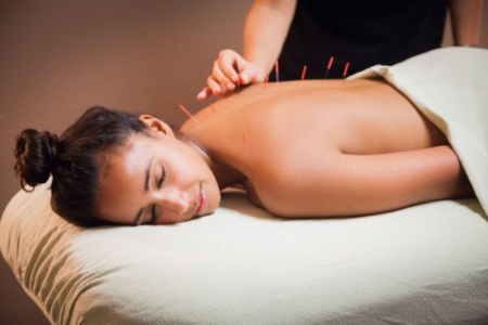 women taking acupuncture