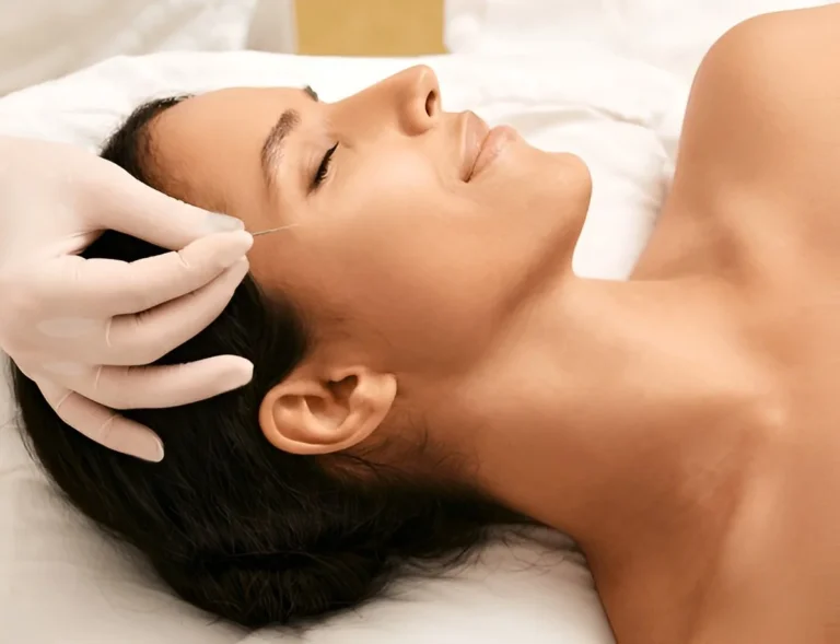 Botox Is Overrated - This Ancient Needle Gave Me a Real Facelift